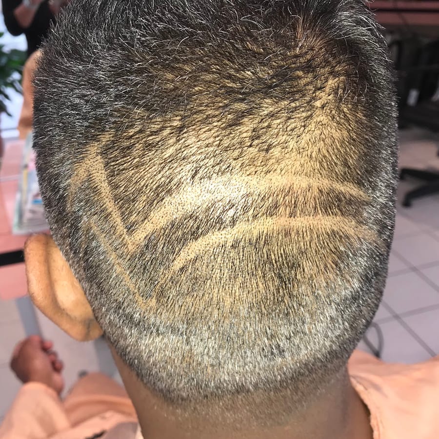 Nuque coupée court avec un motif en lignes tracé à la tondeuse